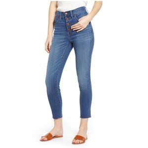 Madewell 10” Button- Front Skinny Crop Jeans